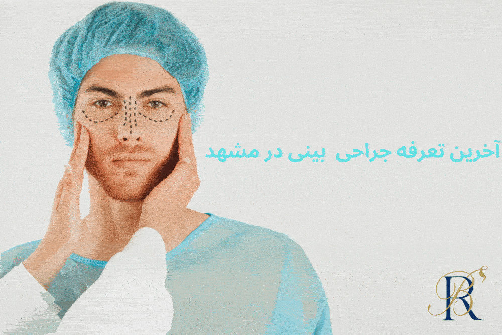 هزینه جراحی بینی در مشهد